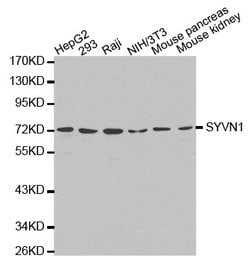 Invitrogen HRD1 Polyclonal Antibody 100 &mu;L; Unconjugated:Antibodies,