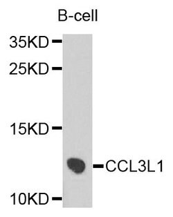 Invitrogen CCL3L1 Polyclonal Antibody 100 &mu;L; Unconjugated:Antibodies,