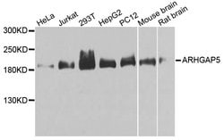 Invitrogen ARHGAP5 Polyclonal Antibody 100 &mu;L; Unconjugated:Antibodies,