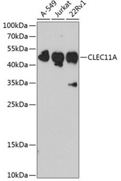 Invitrogen CLEC11A Polyclonal Antibody 100 &mu;L; Unconjugated:Antibodies,
