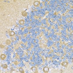 Invitrogen COX6A1 Polyclonal Antibody 100 &mu;L; Unconjugated:Antibodies,