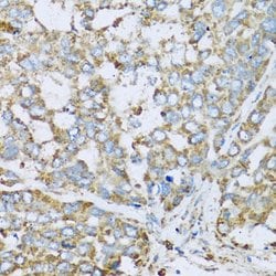 Invitrogen COX6A1 Polyclonal Antibody 100 &mu;L; Unconjugated:Antibodies,