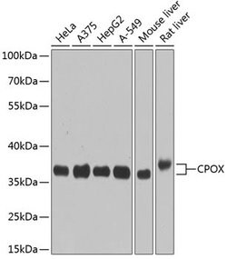 Invitrogen CPOX Polyclonal Antibody 100 &mu;L | Buy Online | Invitrogen&trade; | Fisher Scientific