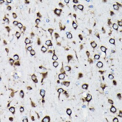 Invitrogen RPL23A Polyclonal Antibody 100 &mu;L; Unconjugated:Antibodies,