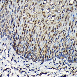 Invitrogen RPL23A Polyclonal Antibody 100 &mu;L; Unconjugated:Antibodies,