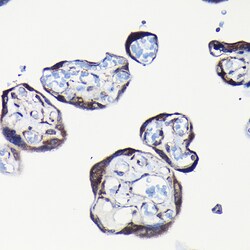 Invitrogen RPL23A Polyclonal Antibody 100 &mu;L; Unconjugated:Antibodies,