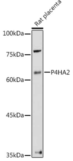 Invitrogen P4HA2 Polyclonal Antibody 100 &mu;L; Unconjugated:Antibodies,