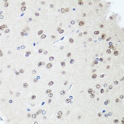 SAP18 Polyclonal Antibody:Antibodies, Polyclonal
