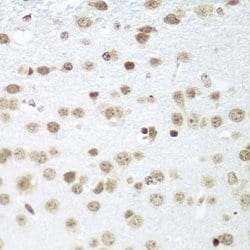 SAP18 Polyclonal Antibody:Antibodies, Polyclonal