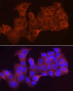 Invitrogen LPCAT1 Polyclonal Antibody 100 &mu;L; Unconjugated:Antibodies,