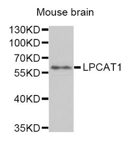 Invitrogen LPCAT1 Polyclonal Antibody 100 &mu;L; Unconjugated:Antibodies,