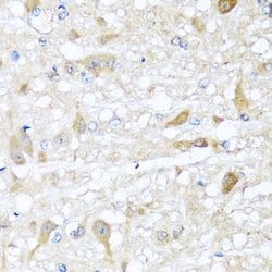 Invitrogen CBR4 Polyclonal Antibody 100 &mu;L; Unconjugated:Antibodies,