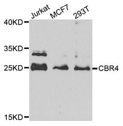 Invitrogen CBR4 Polyclonal Antibody 100 &mu;L; Unconjugated:Antibodies,