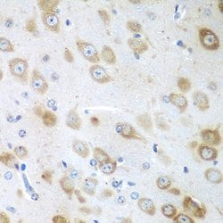 Invitrogen GFM1 Polyclonal Antibody 100 &mu;L; Unconjugated:Antibodies,