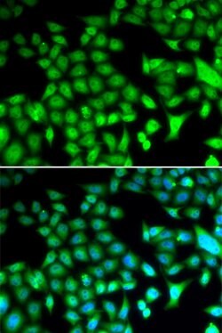 Invitrogen Fra1 Polyclonal Antibody 100 &mu;L; Unconjugated:Antibodies,