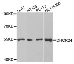 Invitrogen DHCR24 Polyclonal Antibody 100 &mu;L | Buy Online | Invitrogen&trade; | Fisher Scientific