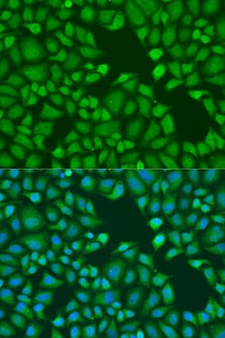 TNRC6A Polyclonal Antibody:Antibodies, Polyclonal