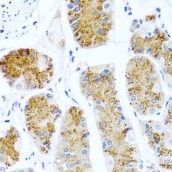 Invitrogen C8orf4 Polyclonal Antibody 100 &mu;L; Unconjugated:Antibodies,