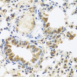 Invitrogen C8orf4 Polyclonal Antibody 100 &mu;L; Unconjugated:Antibodies,