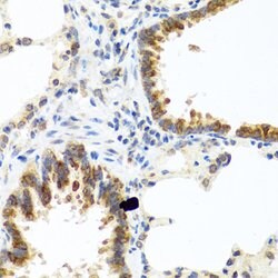 Invitrogen C8orf4 Polyclonal Antibody 100 &mu;L; Unconjugated:Antibodies,