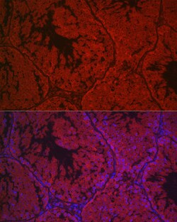 Invitrogen LHR Polyclonal Antibody 100 &mu;L; Unconjugated:Antibodies,