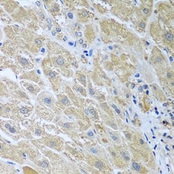Invitrogen WDR48 Polyclonal Antibody 100 &mu;L; Unconjugated:Antibodies,