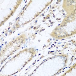 Invitrogen WDR48 Polyclonal Antibody 100 &mu;L; Unconjugated:Antibodies,