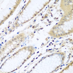 Invitrogen WDR48 Polyclonal Antibody 100 &mu;L; Unconjugated:Antibodies,