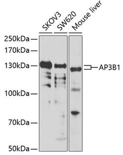 Invitrogen AP3B1 Polyclonal Antibody 100 &mu;L; Unconjugated:Antibodies,