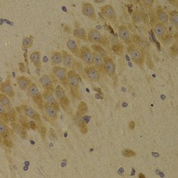 Invitrogen SCO2 Polyclonal Antibody 100 &mu;L; Unconjugated:Antibodies,