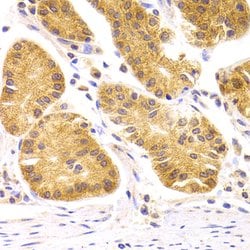 Invitrogen SCO2 Polyclonal Antibody 100 &mu;L; Unconjugated:Antibodies,