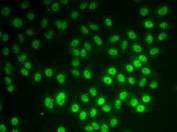 Invitrogen SNRPD1 Polyclonal Antibody 100 &mu;L; Unconjugated:Antibodies,