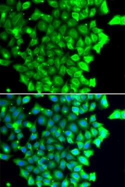 Invitrogen TRIAP1 Polyclonal Antibody 100 &mu;L; Unconjugated:Antibodies,