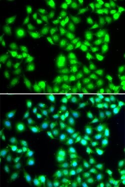 Invitrogen YTHDC1 Polyclonal Antibody 100 &mu;L; Unconjugated:Antibodies,