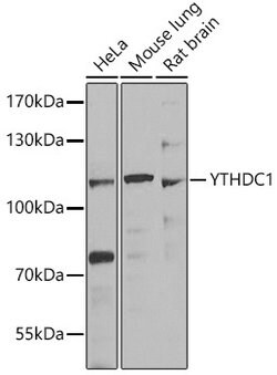 Invitrogen YTHDC1 Polyclonal Antibody 100 &mu;L; Unconjugated:Antibodies,