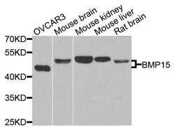 Invitrogen BMP-15 Polyclonal Antibody 100 &mu;L; Unconjugated:Antibodies,