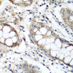 Invitrogen NAT15 Polyclonal Antibody 100 &mu;L; Unconjugated:Antibodies,