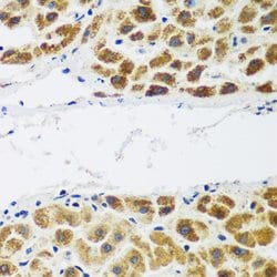 Invitrogen NAT15 Polyclonal Antibody 100 &mu;L; Unconjugated:Antibodies,