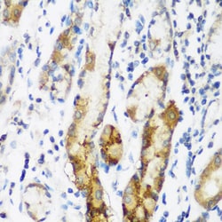 Invitrogen NAT15 Polyclonal Antibody 100 &mu;L; Unconjugated:Antibodies,