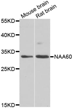 Invitrogen NAT15 Polyclonal Antibody 100 &mu;L; Unconjugated:Antibodies,