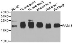 Invitrogen RAB31 Polyclonal Antibody 100 &mu;L | Buy Online | Invitrogen&trade; | Fisher Scientific