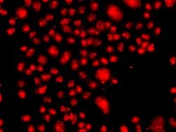 FANCM Polyclonal Antibody:Antibodies, Polyclonal