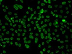 Invitrogen PLCXD2 Polyclonal Antibody 100 &mu;L; Unconjugated:Antibodies,