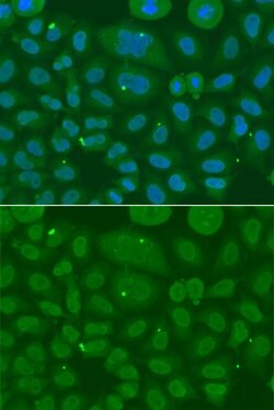 Invitrogen ANXA8L1 Polyclonal Antibody 100 &mu;L; Unconjugated:Antibodies,