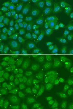 Invitrogen ANXA8L1 Polyclonal Antibody 100 &mu;L; Unconjugated:Antibodies,
