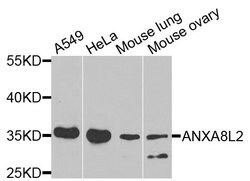 Invitrogen ANXA8L1 Polyclonal Antibody 100 &mu;L; Unconjugated:Antibodies,