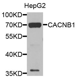 Invitrogen CACNB1 Polyclonal Antibody 100 &mu;L; Unconjugated:Antibodies,