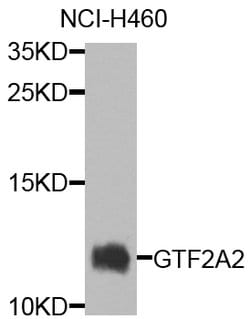 Invitrogen GTF2A2 Polyclonal Antibody 100 &mu;L | Buy Online | Invitrogen&trade; | Fisher Scientific