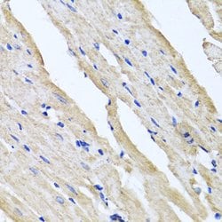 Invitrogen RCN2 Polyclonal Antibody 100 &mu;L; Unconjugated:Antibodies,
