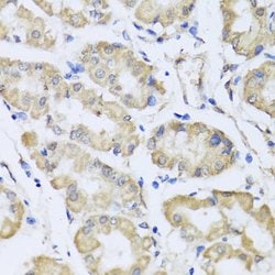 Invitrogen RCN2 Polyclonal Antibody 100 &mu;L; Unconjugated:Antibodies,